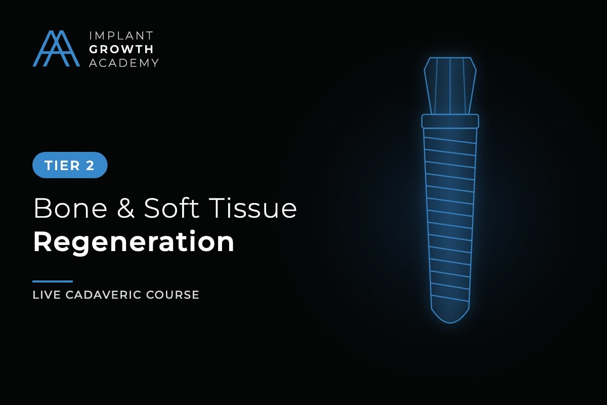 Implant Growth Academy TIER 2